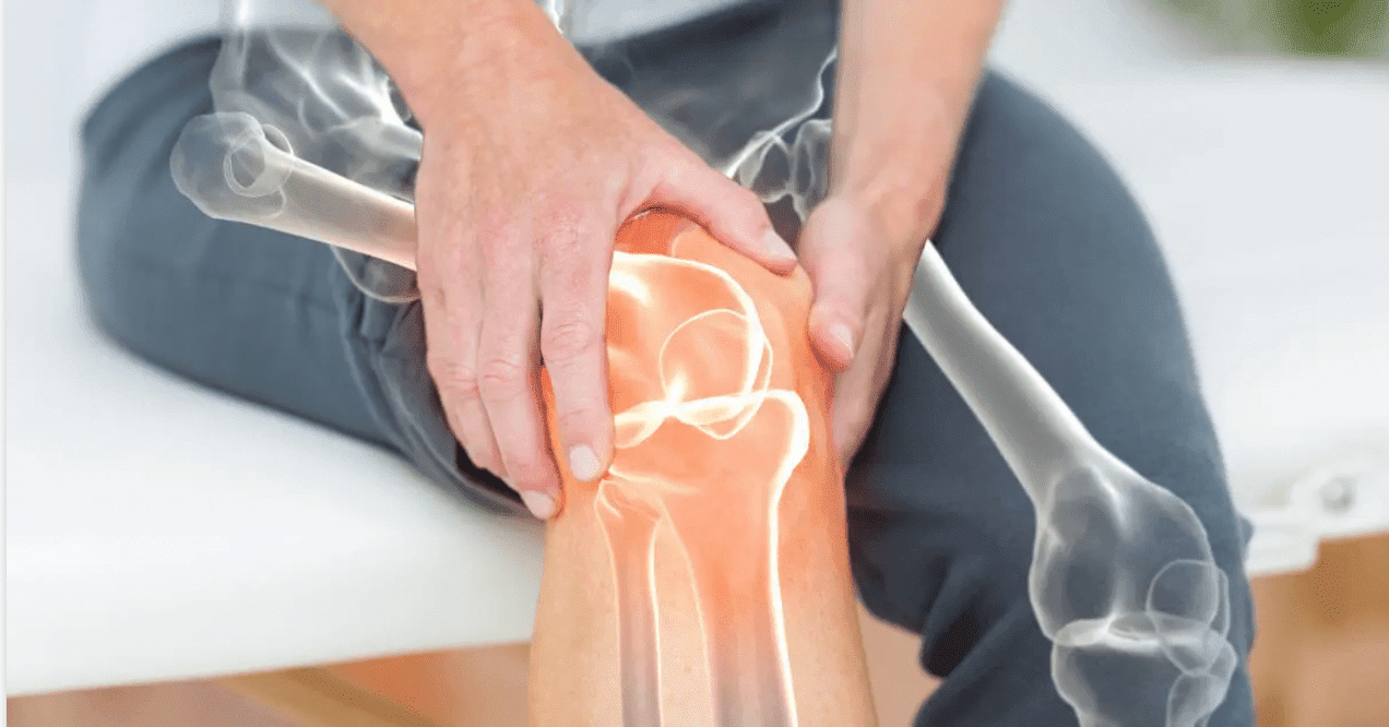 Knie-Artrose
